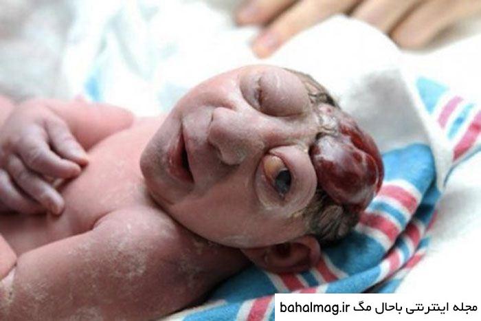 عکس ترسناک در حد مرگ