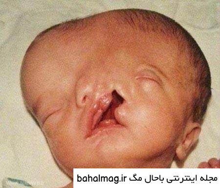 عکس ترسناک در حد مرگ