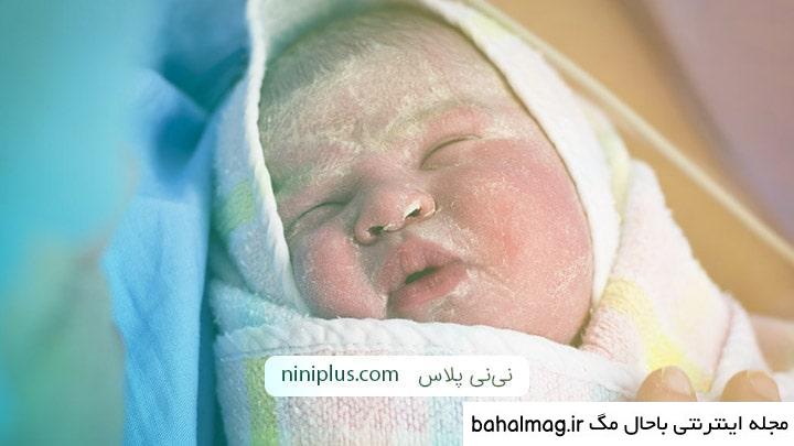 عکس نی نی تازه متولد شده خاص
