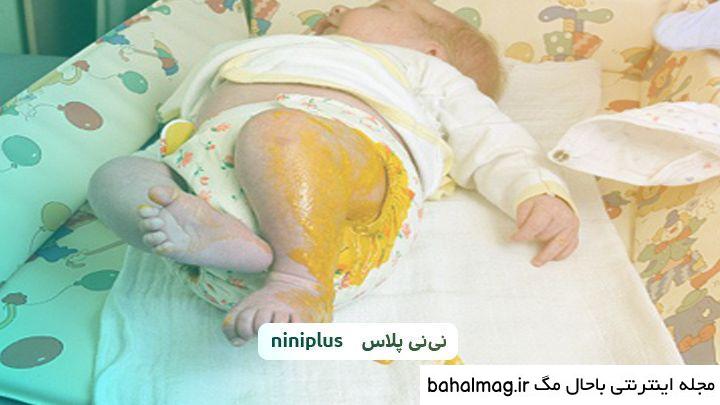 عکسهای نی نی تازه متولد شده